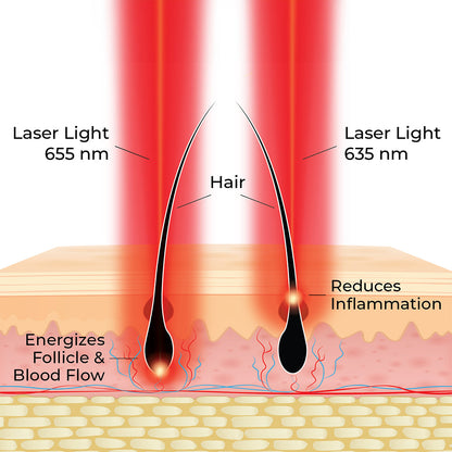 Hairmax Actonis™ 18 Dual Action Hair Growth LaserComb